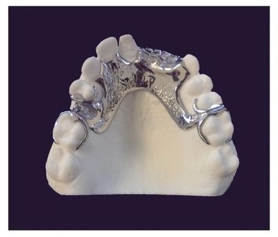 METAL PARTIAL FRAMEWORK | HS Dental lab