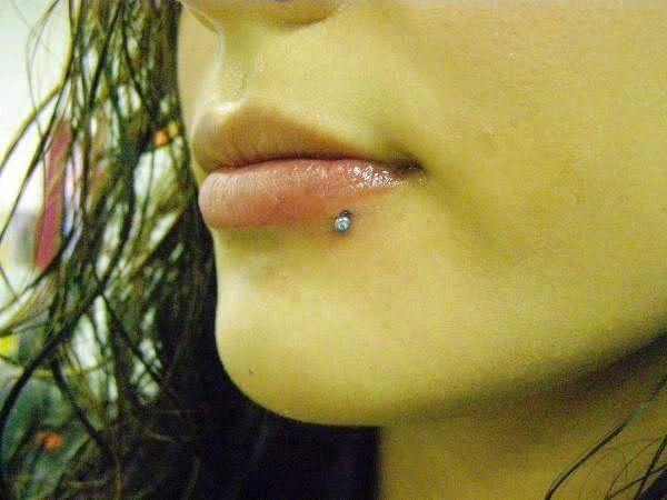 lip ring scar tissue build up