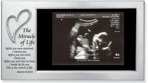 Baby - Pregnancy - Ultrasound Frame - Cathedral Art