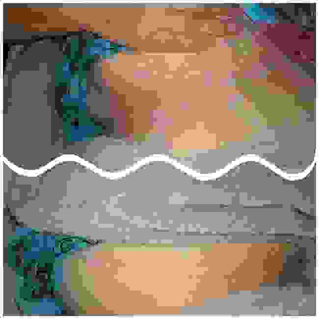 results
scar tissue release
scar
trauma
natural
healing
wellbeing
physical
emotional