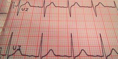 Electrocardiogram (ECG) at Dr Amonkar's Cardiac Clinic
