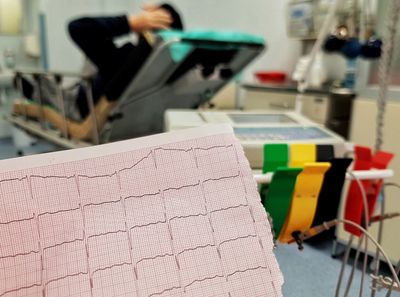 ECG - Electrocardiogram