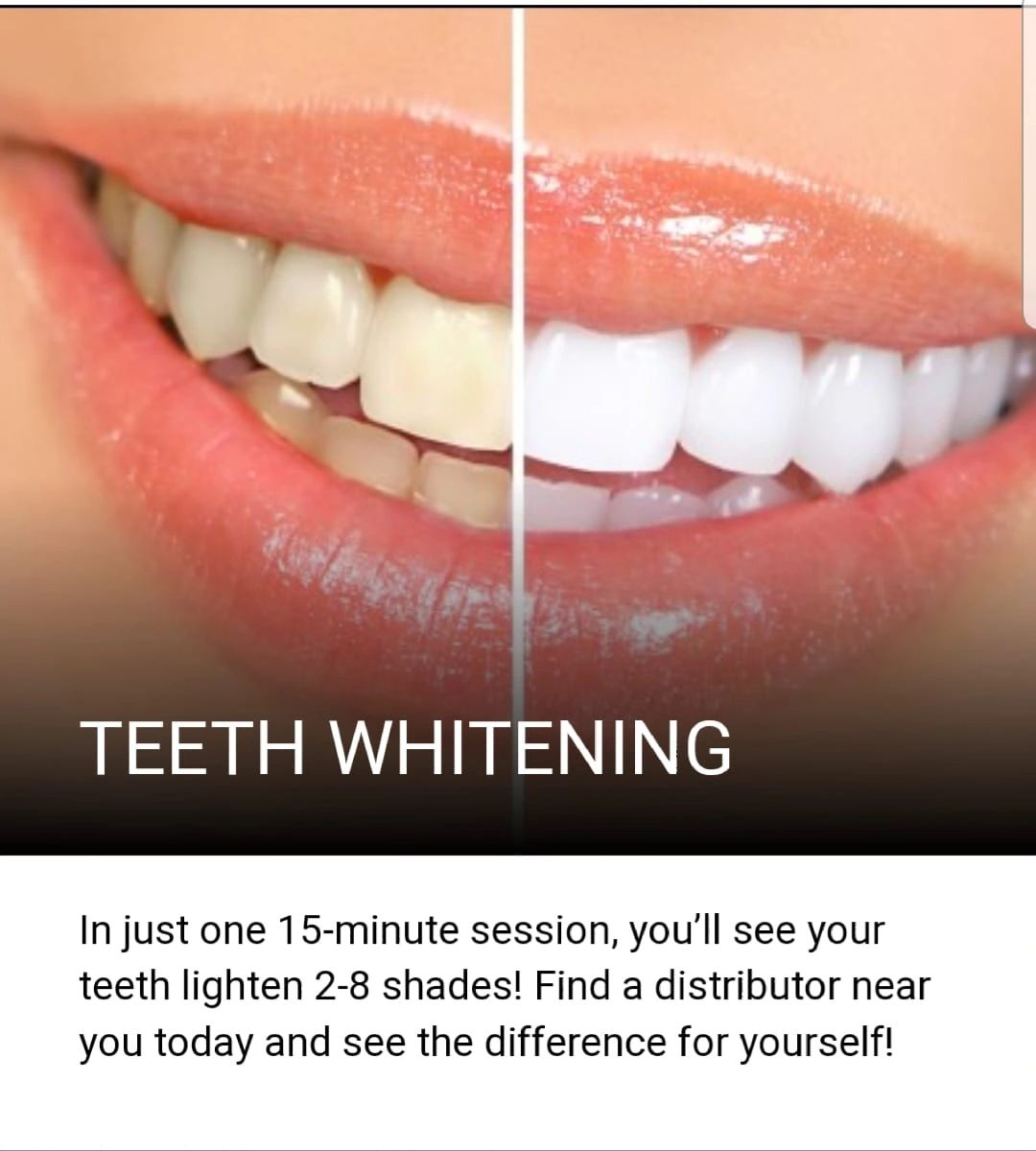 BleachBright Teeth Whitening