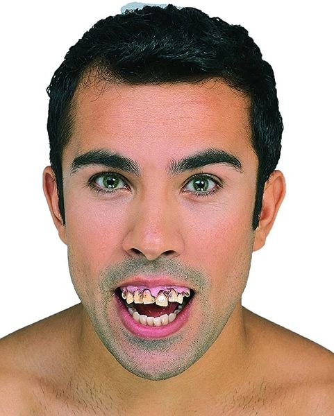 *Bejeweled Ugly Teeth -Halloween Costume Accessory