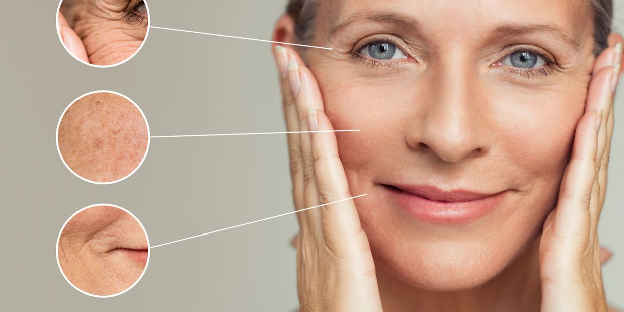 full-face behandling filler botox