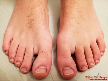 Male feet and toes after a Stellar men's pedicure with callous/dead skin removal, cutting, filing, e